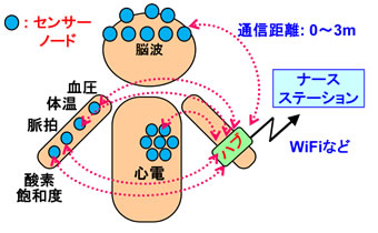 図1： BANシステムの構成例