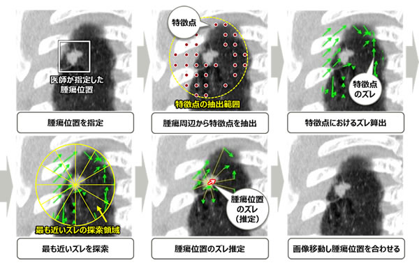 図3 開発技術による腫瘍位置の位置合わせ