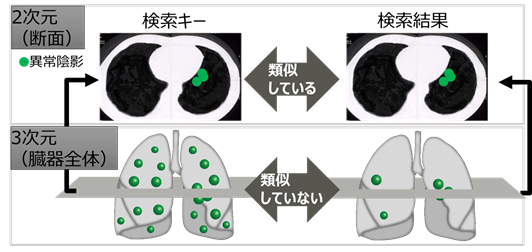 図1 従来の類似症例検索