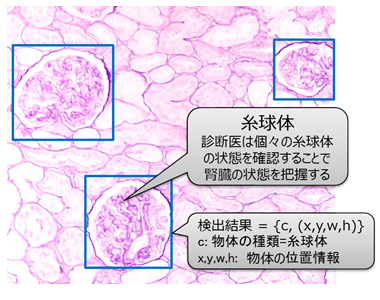 図1 腎生検画像と糸球体検出