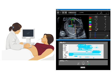 図 AIを用いた胎児心臓超音波スクリーニング