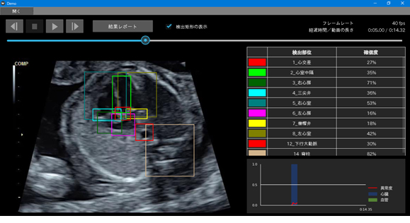 図2 今回開発した、胎児心臓超音波スクリーニング異常検知システム